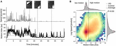 Cortico-Striatal Oscillations Are Correlated to Motor Activity Levels in Both Physiological and Parkinsonian Conditions